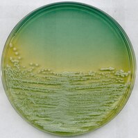 Agar nutritivo WL | 110866